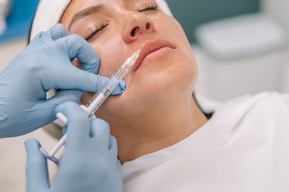 Bioestimulación de Colágeno